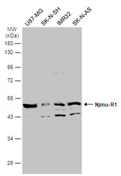 Anti-C17orf75 antibody [N1C1] used in Western Blot (WB). GTX108779