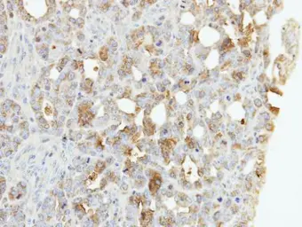 Anti-ZNF223 antibody [N1N3] used in IHC (Paraffin sections) (IHC-P). GTX108781