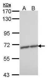 Anti-ZNF223 antibody [N1N3] used in Western Blot (WB). GTX108781