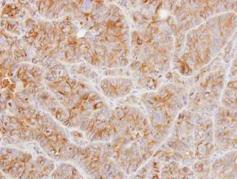 Anti-alpha Tubulin antibody used in IHC (Paraffin sections) (IHC-P). GTX108784