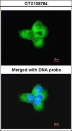Anti-alpha Tubulin antibody used in Immunocytochemistry/ Immunofluorescence (ICC/IF). GTX108784