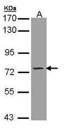 Anti-PDE9A antibody [N1N3] used in Western Blot (WB). GTX108786