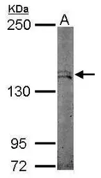 Anti-STK36 antibody [N1N2], N-term used in Western Blot (WB). GTX108794