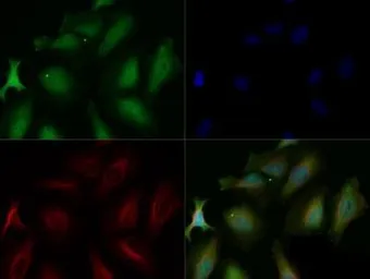 Anti-PHD3 antibody used in Immunocytochemistry/ Immunofluorescence (ICC/IF). GTX10880