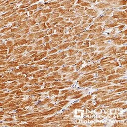 Anti-PHD3 antibody used in IHC (Paraffin sections) (IHC-P). GTX10880