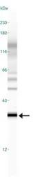 Anti-PHD3 antibody used in Western Blot (WB). GTX10880