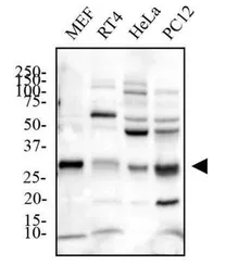 Anti-PHD3 antibody used in Western Blot (WB). GTX10880