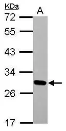 Anti-DLX1 antibody [N1C3-2] used in Western Blot (WB). GTX108804