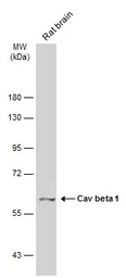 Anti-Cav beta 1 antibody [C1C3] used in Western Blot (WB). GTX108807