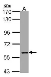 Anti-MTGR1 antibody [C1C3] used in Western Blot (WB). GTX108813