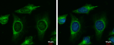 Anti-MAP4K6 antibody [C2C3-2], C-term used in Immunocytochemistry/ Immunofluorescence (ICC/IF). GTX108816