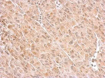 Anti-MAP4K6 antibody [C2C3-2], C-term used in IHC (Paraffin sections) (IHC-P). GTX108816