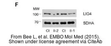 Anti-DNA ligase IV antibody used in Western Blot (WB). GTX108820