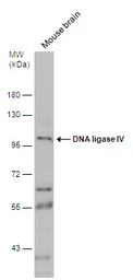 Anti-DNA ligase IV antibody used in Western Blot (WB). GTX108820