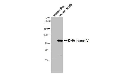 Anti-DNA ligase IV antibody used in Western Blot (WB). GTX108820