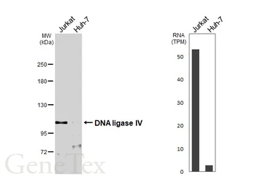 Anti-DNA ligase IV antibody used in Western Blot (WB). GTX108820
