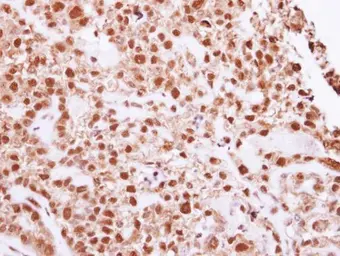 Anti-DNA ligase IV antibody used in IHC (Paraffin sections) (IHC-P). GTX108820