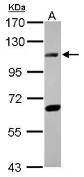 Anti-DNA ligase IV antibody used in Western Blot (WB). GTX108820