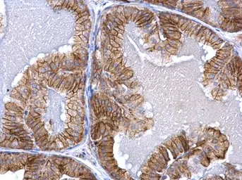 Anti-Activin Receptor Type IA antibody used in IHC (Paraffin sections) (IHC-P). GTX108827