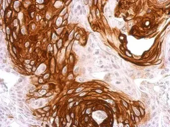 Anti-Activin Receptor Type IA antibody used in IHC (Paraffin sections) (IHC-P). GTX108827