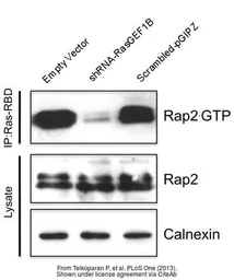 Anti-RAP2A antibody [N1C3-2] used in Western Blot (WB). GTX108831