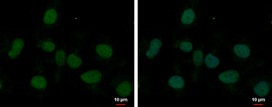 Anti-MED8 antibody used in Immunocytochemistry/ Immunofluorescence (ICC/IF). GTX108837