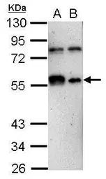 Anti-KLF12 antibody used in Western Blot (WB). GTX108840