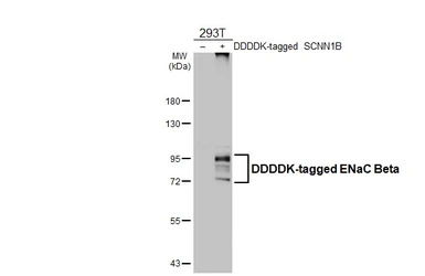 Anti-ENaC Beta antibody [N2C1], Internal used in Western Blot (WB). GTX108842