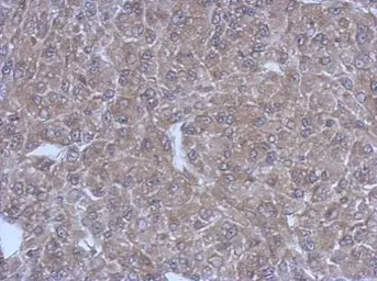 Anti-Bestrophin 1 antibody used in IHC (Paraffin sections) (IHC-P). GTX108854