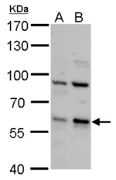 Anti-PCTAIRE2 antibody used in Western Blot (WB). GTX108880