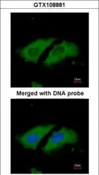 Anti-STK33 antibody [N1C3] used in Immunocytochemistry/ Immunofluorescence (ICC/IF). GTX108881