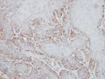Anti-STK33 antibody [N1C3] used in IHC (Paraffin sections) (IHC-P). GTX108881