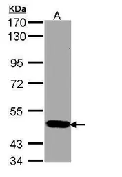 Anti-STK33 antibody [N1C3] used in Western Blot (WB). GTX108881