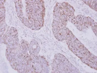 Anti-PSTPIP2 antibody used in IHC (Paraffin sections) (IHC-P). GTX108886