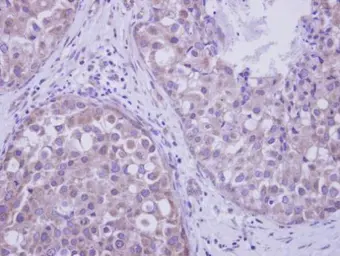 Anti-LIM kinase 2 antibody used in IHC (Paraffin sections) (IHC-P). GTX108903