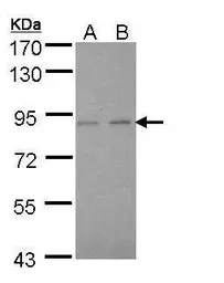 Anti-LIM kinase 2 antibody used in Western Blot (WB). GTX108903