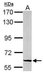 Anti-GRB14 antibody [N1C2] used in Western Blot (WB). GTX108911