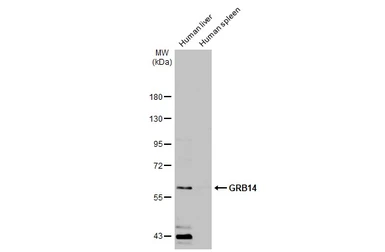 Anti-GRB14 antibody [N1C2] used in Western Blot (WB). GTX108911
