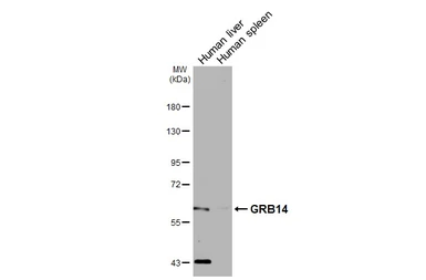 Anti-GRB14 antibody [N1C2] used in Western Blot (WB). GTX108911