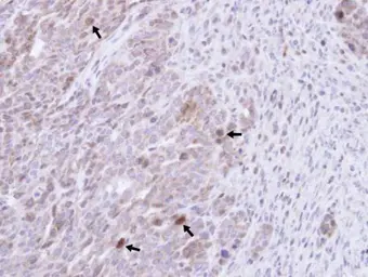 Anti-GRB14 antibody [N1C2] used in IHC (Paraffin sections) (IHC-P). GTX108911