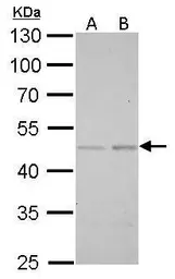 Anti-SMAD5 antibody used in Western Blot (WB). GTX108917