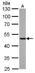 Anti-SMAD5 antibody used in Western Blot (WB). GTX108917