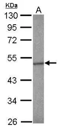 Anti-SMAD5 antibody used in Western Blot (WB). GTX108917