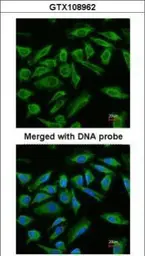 Anti-Abin 2 antibody [N1C2] used in Immunocytochemistry/ Immunofluorescence (ICC/IF). GTX108962