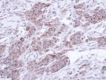 Anti-Abin 2 antibody [N1C2] used in IHC (Paraffin sections) (IHC-P). GTX108962