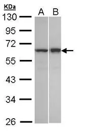 Anti-Abin 2 antibody [N1C2] used in Western Blot (WB). GTX108962