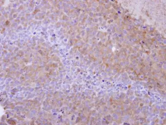 Anti-PPP6C antibody used in IHC (Paraffin sections) (IHC-P). GTX108968