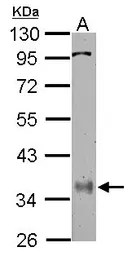 Anti-PPP6C antibody used in Western Blot (WB). GTX108968