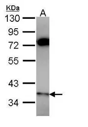 Anti-PPP6C antibody used in Western Blot (WB). GTX108968