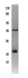 Human AGR3 protein, His tag. GTX108985-pro